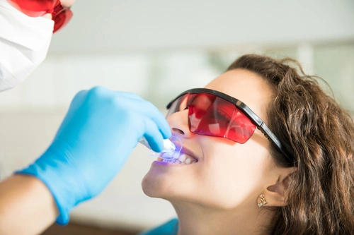 Clareamento Dental Profissional